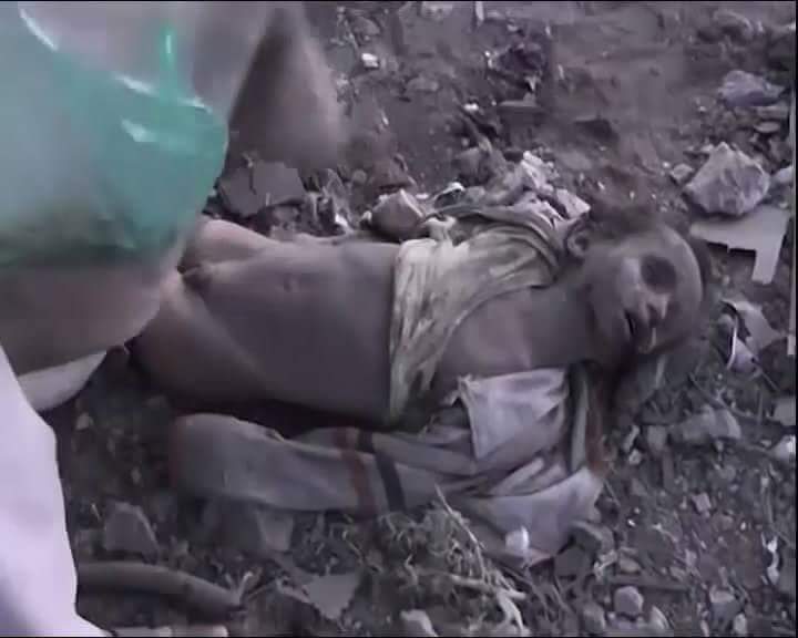 Yemen_War_Image